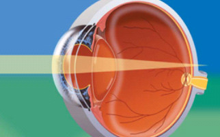Αντιμετώπιση οφθαλμολογικών παθήσεων στο Aktis